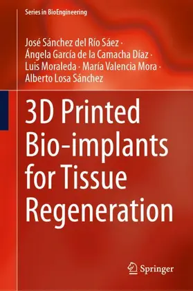3D Printed Bio-implants for Tissue Regeneration
