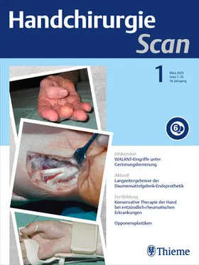 Handchirurgie Scan