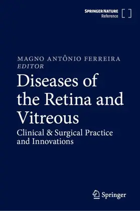 Diseases of the Retina and Vitreous