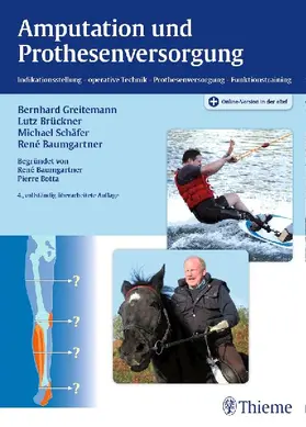 Amputation und Prothesenversorgung